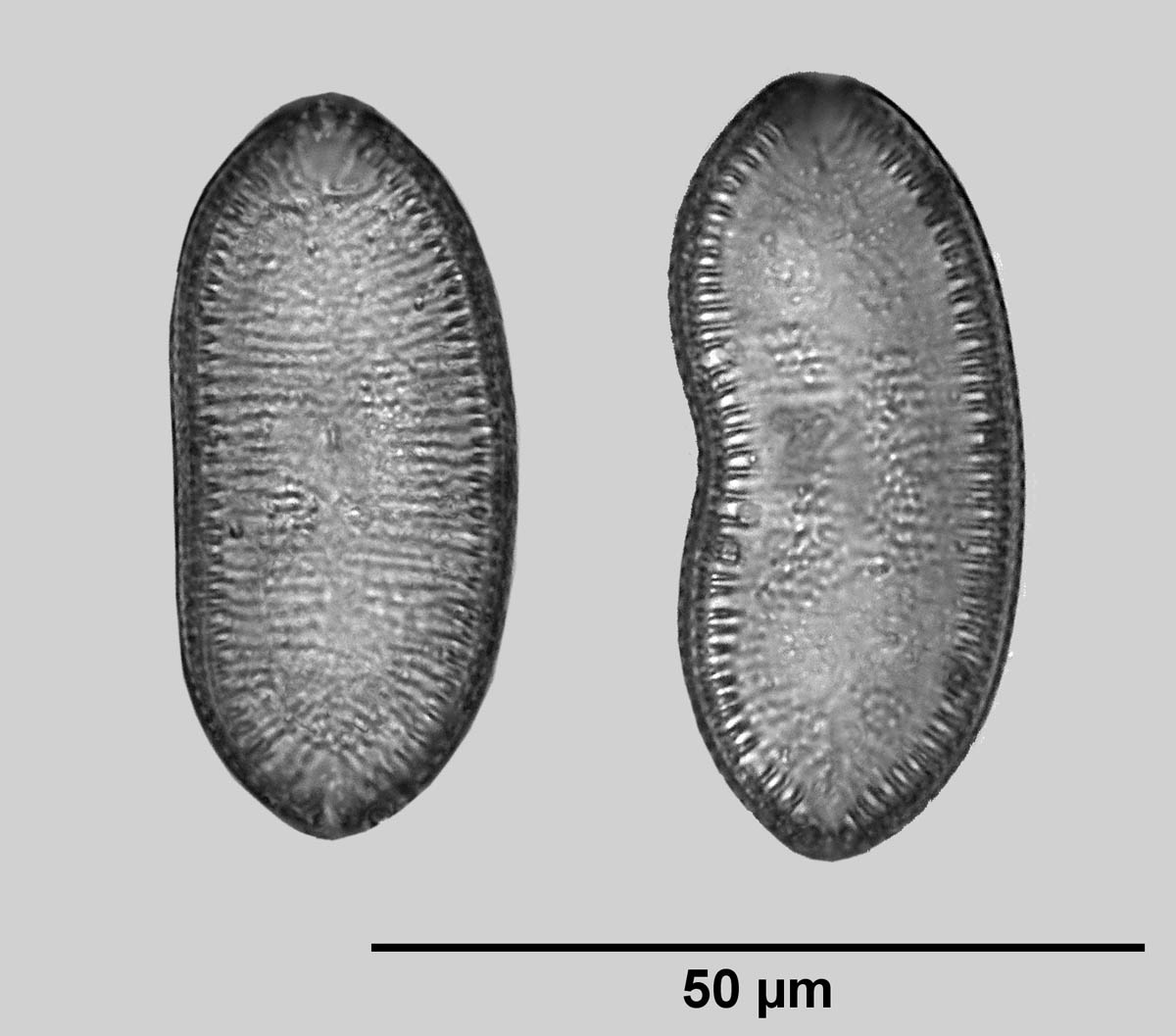 Valves of malformed diatoms