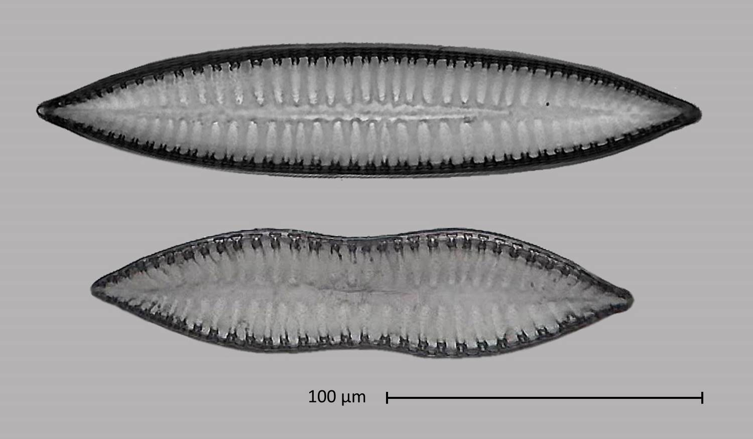 normal and malformed Surirella